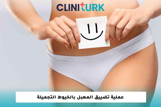 عملية تضييق المهبل بالخيوط التجميلة