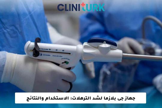 جهاز جى بلازما لشد الترهلات: الاستخدام والنتائج