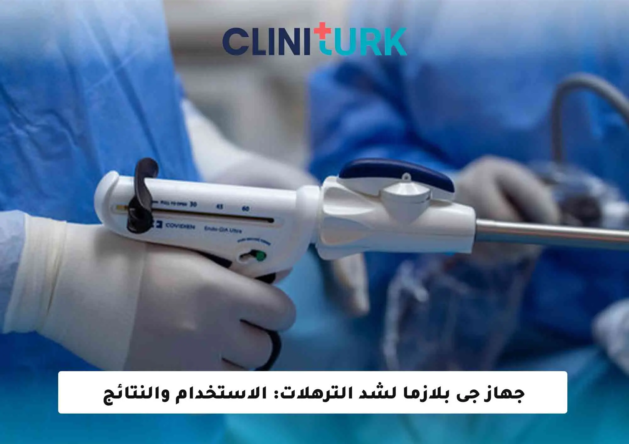 جهاز جى بلازما لشد الترهلات: الاستخدام والنتائج