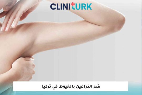 شد الذراعين بالخيوط في تركيا