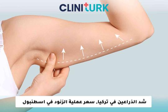 شد الذراعين في تركيا, سعر عملية الزنود في اسطنبول 2025