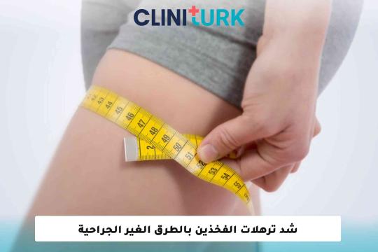 شد ترهلات الفخذين بالطرق الغير الجراحية