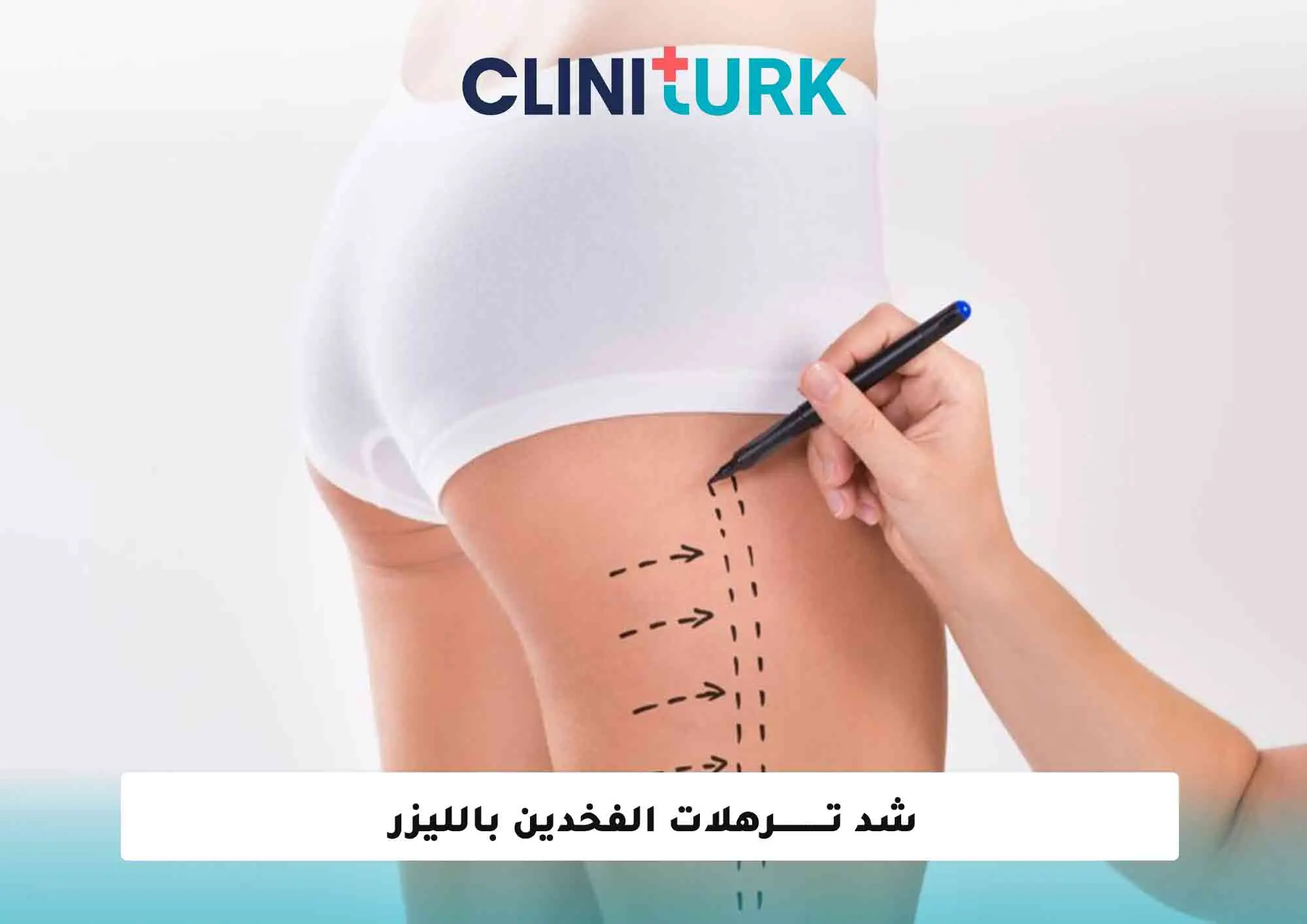 شد ترهلات الفخدين بالليزر