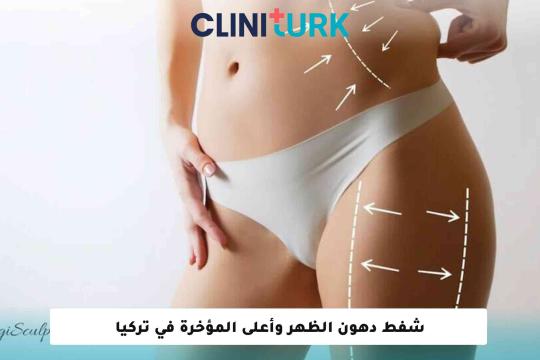 شفط دهون الظهر وأعلى المؤخرة في تركيا