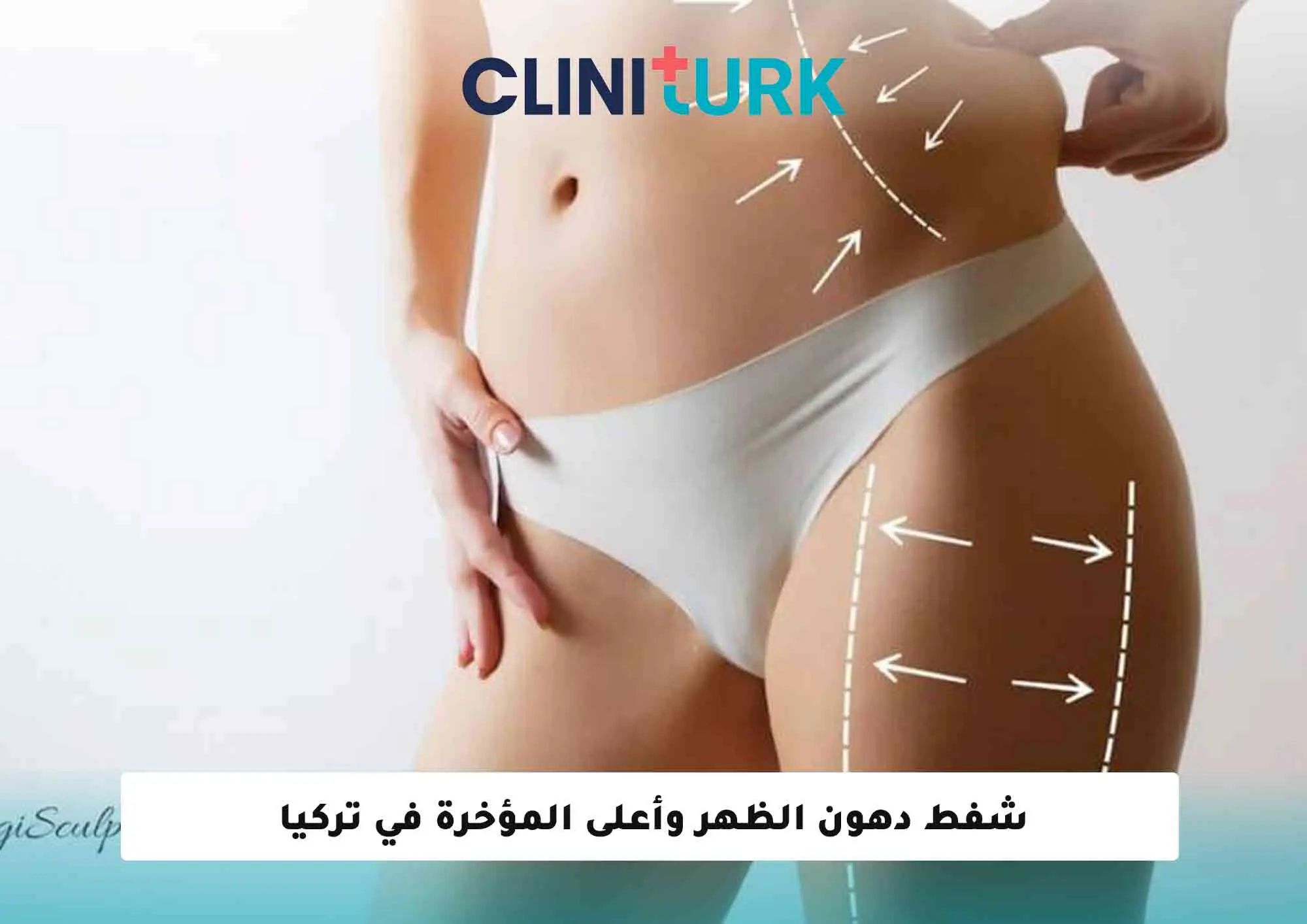 شفط دهون الظهر وأعلى المؤخرة في تركيا