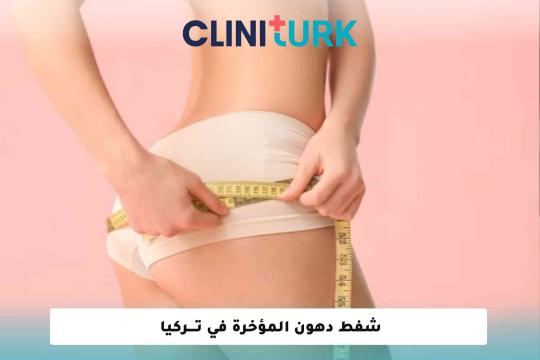شفط دهون المؤخرة في تركيا 2025