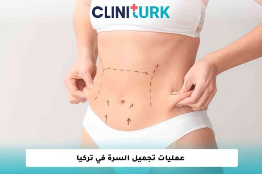 عمليات تجميل السرة في تركيا