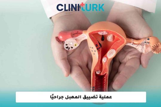 عملية تضييق المهبل جراحيًا