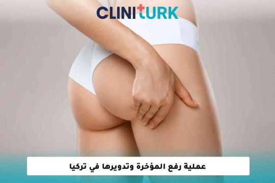 عملية رفع المؤخرة وتدويرها في تركيا