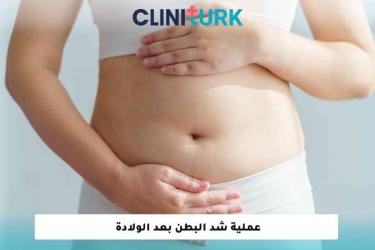 عملية شد البطن بعد الولادة