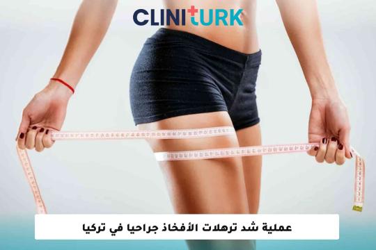 عملية شد الأفخاذ جراحياً في تركيا
