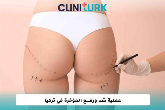 عملية شد ورفع المؤخرة في تركيا