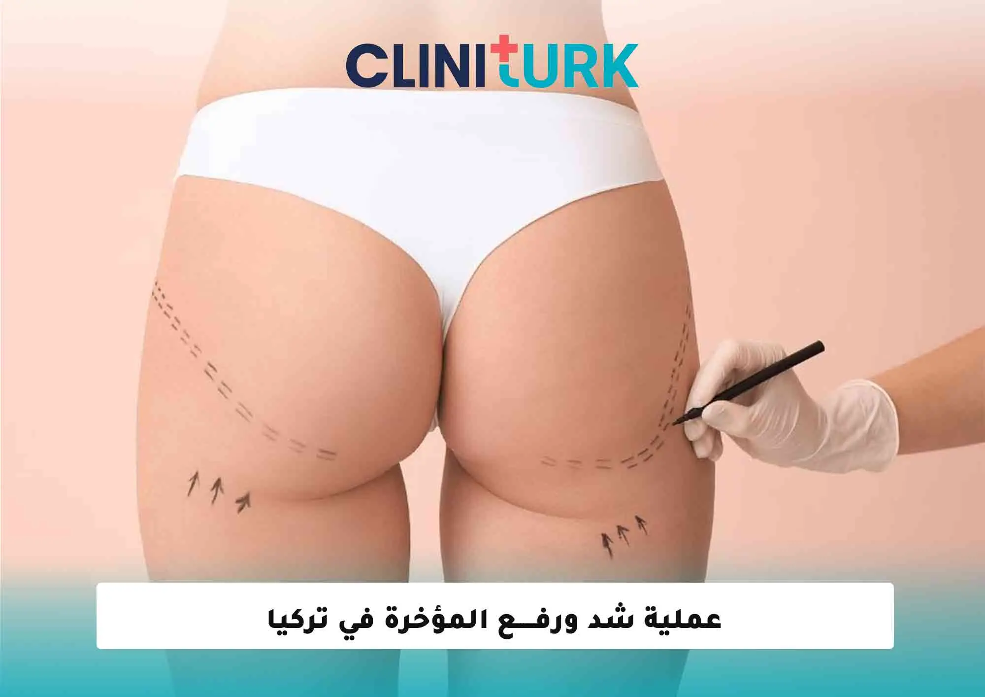 عملية شد ورفع المؤخرة في تركيا