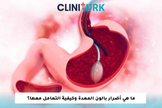 ما هي أضرار بالون المعدة وكيفية التعامل معها؟
