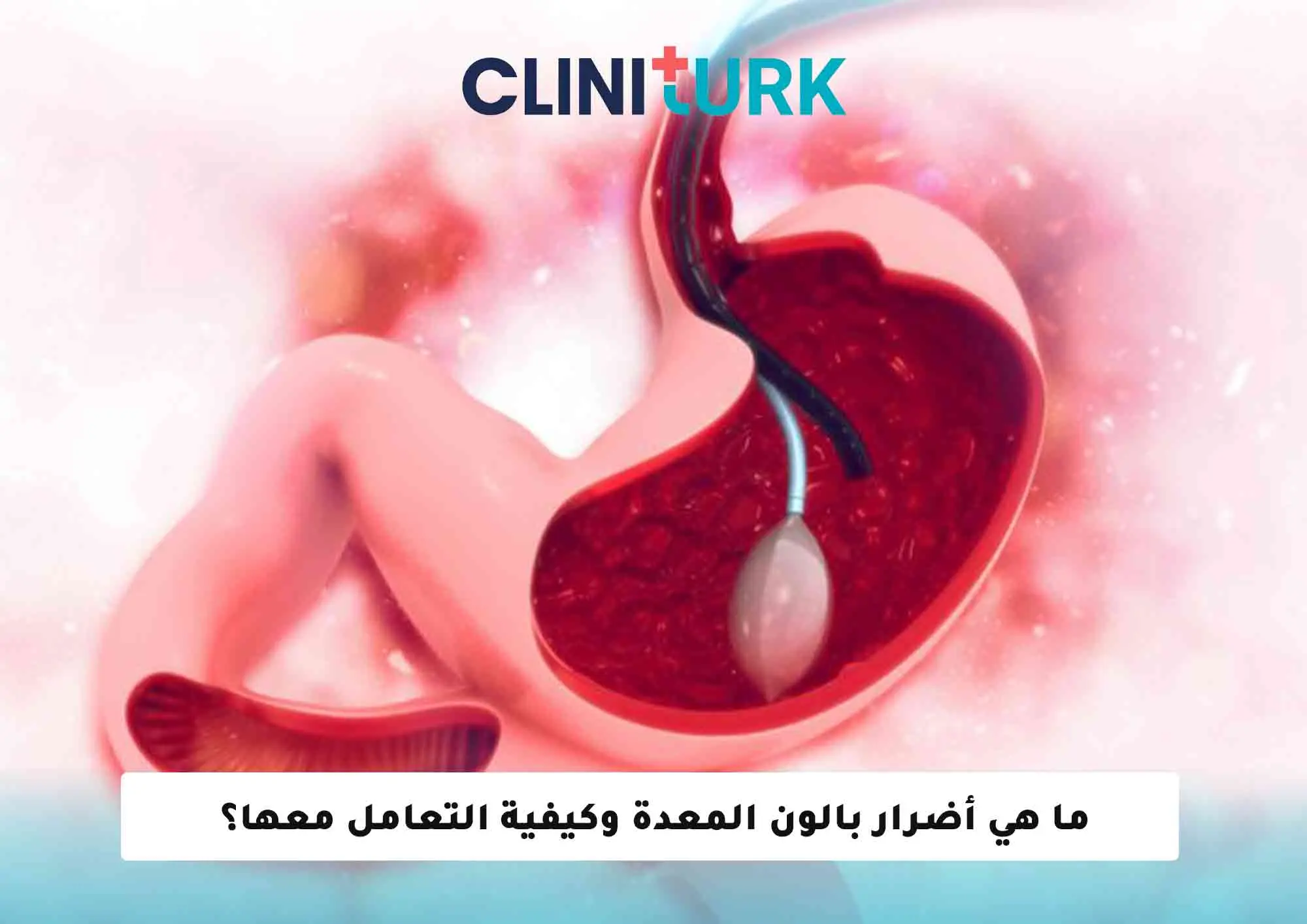 ما هي أضرار بالون المعدة وكيفية التعامل معها؟